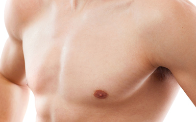 Eliminating Gynaecomastia or Male Breast Reduction