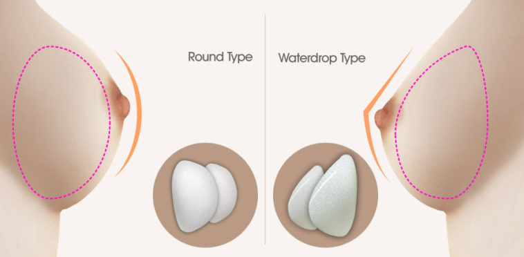 Teardrop vs Round Implant  Teardrop vs. Round Breast Implant Shapes 