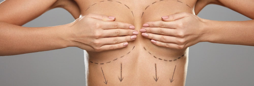 Breast reduction surgery: Woman with J-cup breasts transformed